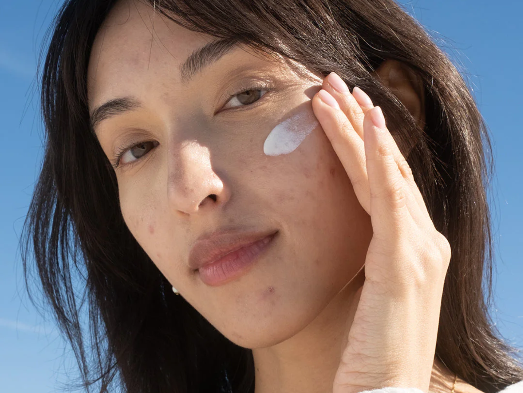 Does Sunscreen Help With Hyperpigmentation? What To Know About SPF and Dark Spots